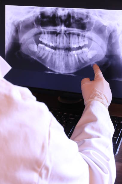 Best Emergency Root Canal Treatment in Grottoes, VA