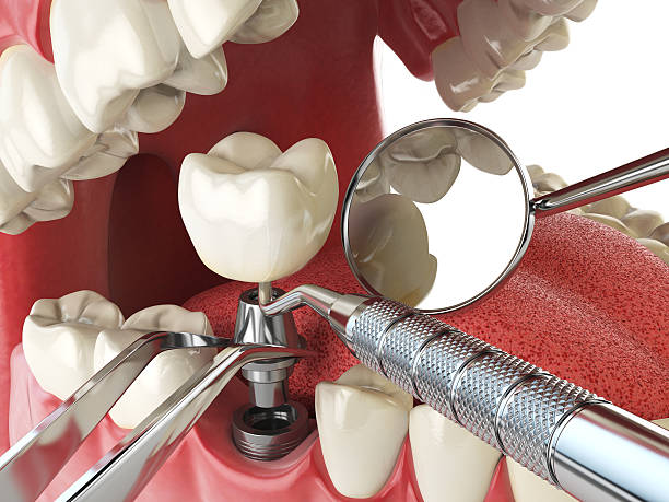 Best Pediatric Emergency Dentist in Grottoes, VA